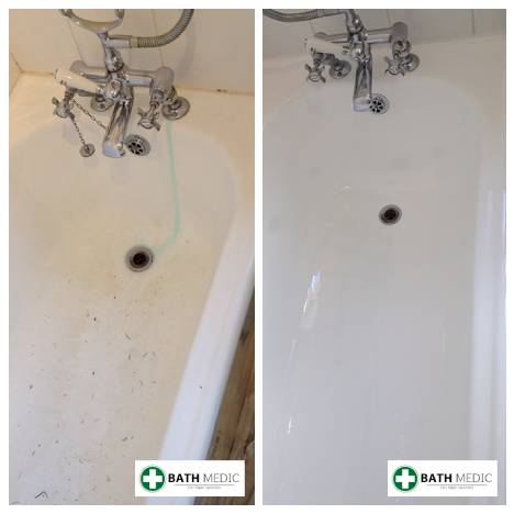 Bath chip repair Edinburgh St Christophers Inn — Bath Medic
