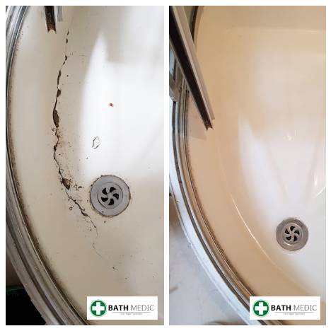 Shower tray repair Edinburgh listed building — Bath Medic